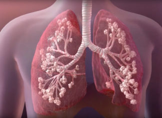 4.5% are carriers of Cystic Fibrosis gene among 200 people ; frequency to be higher in India than the west – Study by Sir Gang Ram Hospital