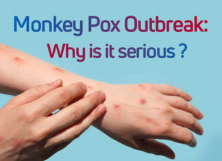 India confirms first case of Monkey pox , isolated patient found positive