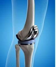 97 Year Old Indian Undergoes Knee Replacement Surgery at Fortis Hospital Vasant Kunj